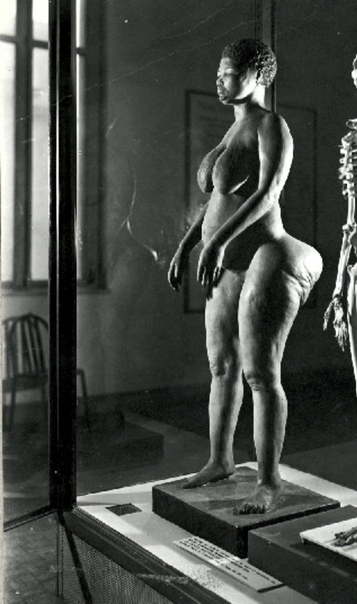 Анатомические особенности женщины из африканского народа готтентотов. Саарти Баартман была привезена в Европу из Южной Африки в начале XIX века и её выставляли в паноптикумах на показ публике