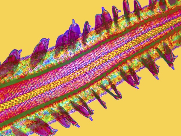 Кончик языка бабочки в поляризованном свете, 720-x Фото: Stephen S. Nagy, M.D.