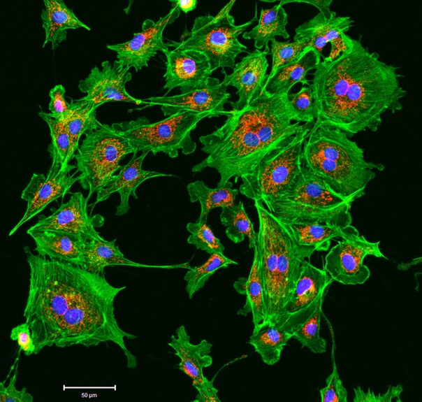 Изображение, полученное с помощью флуоресцентного микроскопа, показывает клеточные мембраны (зеленый , ядро (синий) и цитоскелет (красный) эндотелиальных клеток. (Эндотелий - это особые клетки,