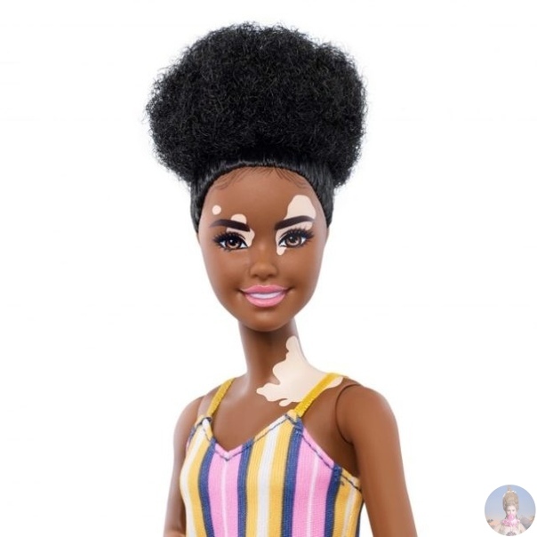 Похоже, компания Mattel не оставляет попыток выпустить Барби здорового человека: среди новинок кукла с витилиго и даже Кен с длинными