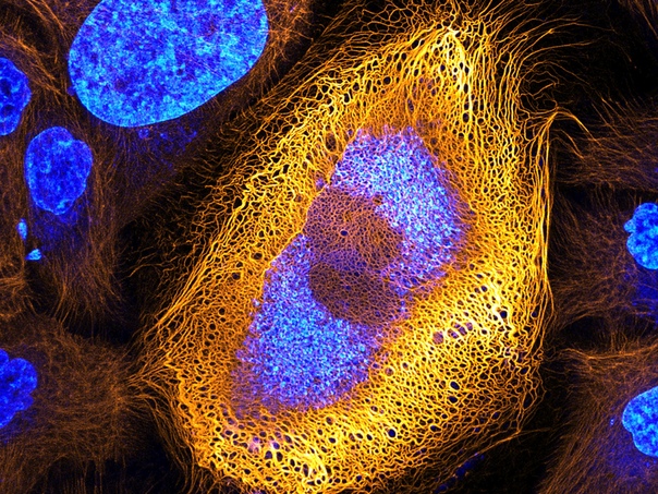 Микрофото клетки человеческой кожи с подсвеченным внутри нее большим количеством кератина Фото: Dr. Bram van den