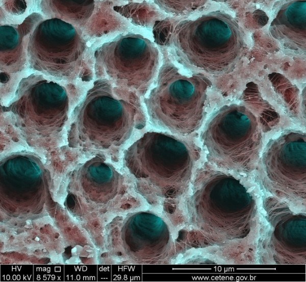 Структура человеческого зуба под микроскопом